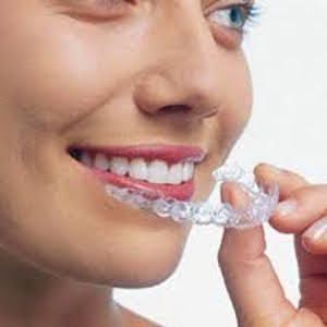 invisalign clear aligners